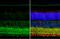 Glutamate Decarboxylase 1 antibody, GTX101881, GeneTex, Immunohistochemistry paraffin image 