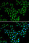 Anti-Silencing Function 1A Histone Chaperone antibody, 22-288, ProSci, Immunofluorescence image 