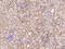 TNA antibody, 50700-T24, Sino Biological, Immunohistochemistry paraffin image 