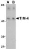 T Cell Immunoglobulin And Mucin Domain Containing 4 antibody, TA306322, Origene, Western Blot image 