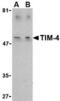 T Cell Immunoglobulin And Mucin Domain Containing 4 antibody, TA306322, Origene, Western Blot image 