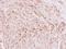 Glycine Decarboxylase antibody, LS-C186145, Lifespan Biosciences, Immunohistochemistry frozen image 