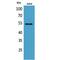 Matrix Metallopeptidase 12 antibody, LS-C386901, Lifespan Biosciences, Western Blot image 