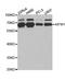 Apoptosis Inducing Factor Mitochondria Associated 1 antibody, TA332560, Origene, Western Blot image 