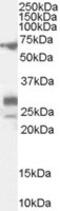 Spalt Like Transcription Factor 4 antibody, MBS420629, MyBioSource, Western Blot image 