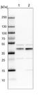PHD Finger Protein 6 antibody, NBP1-88646, Novus Biologicals, Western Blot image 