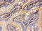 Isocitrate Dehydrogenase (NADP(+)) 2, Mitochondrial antibody, PB9602, Boster Biological Technology, Immunohistochemistry frozen image 