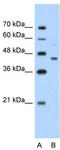 Creatine Kinase, Mitochondrial 2 antibody, TA346081, Origene, Western Blot image 