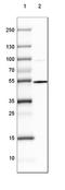 Doublecortin Like Kinase 1 antibody, NBP2-48530, Novus Biologicals, Western Blot image 