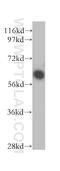 Proteasome 26S Subunit, Non-ATPase 3 antibody, 12054-1-AP, Proteintech Group, Western Blot image 