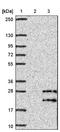 Transforming Growth Factor Alpha antibody, NBP1-87501, Novus Biologicals, Western Blot image 