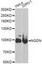 Ribonucleotide Reductase Catalytic Subunit M1 antibody, A13656, ABclonal Technology, Western Blot image 