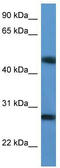 TM2 Domain Containing 2 antibody, TA342997, Origene, Western Blot image 