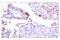 Checkpoint Kinase 2 antibody, 82263S, Cell Signaling Technology, Immunohistochemistry paraffin image 