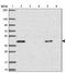 Potassium Voltage-Gated Channel Subfamily J Member 16 antibody, NBP2-34127, Novus Biologicals, Western Blot image 