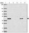 Inward rectifier potassium channel 16 antibody, NBP2-34127, Novus Biologicals, Western Blot image 