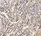 Huntingtin Interacting Protein 1 Related antibody, A05059-2, Boster Biological Technology, Immunohistochemistry paraffin image 