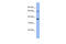 Tamm-Horsfall urinary glycoprotein antibody, ARP41436_P050, Aviva Systems Biology, Western Blot image 