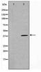 TNF Superfamily Member 11 antibody, TA347523, Origene, Western Blot image 