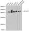Rho GTPase Activating Protein 5 antibody, GTX65862, GeneTex, Western Blot image 