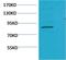 Signal Transducer And Activator Of Transcription 5A antibody, STJ97465, St John