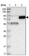 Gamma-Glutamyltransferase 7 antibody, PA5-53035, Invitrogen Antibodies, Western Blot image 