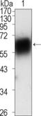 Tyrosine-protein kinase transmembrane receptor ROR1 antibody, NBP1-47449, Novus Biologicals, Western Blot image 