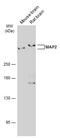 MAP2 antibody, GTX634471, GeneTex, Western Blot image 