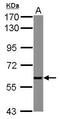 X-Linked Inhibitor Of Apoptosis antibody, GTX111202, GeneTex, Western Blot image 