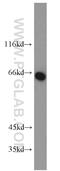 Carboxypeptidase A6 antibody, 13604-1-AP, Proteintech Group, Western Blot image 