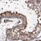 THAP Domain Containing 9 antibody, PA5-57947, Invitrogen Antibodies, Immunohistochemistry frozen image 