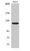 Protein Tyrosine Kinase 2 antibody, STJ93025, St John