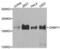 DNA Methyltransferase 1 antibody, abx004212, Abbexa, Western Blot image 