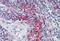 Vav Guanine Nucleotide Exchange Factor 3 antibody, orb88766, Biorbyt, Immunohistochemistry paraffin image 