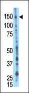 BMP2 Inducible Kinase antibody, 59-055, ProSci, Western Blot image 