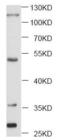 CD40 Molecule antibody, FNab01477, FineTest, Western Blot image 