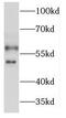 Potassium Voltage-Gated Channel Subfamily J Member 2 antibody, FNab04579, FineTest, Western Blot image 