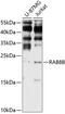 RAB8B, Member RAS Oncogene Family antibody, 19-128, ProSci, Western Blot image 