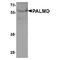 Palmdelphin antibody, TA349191, Origene, Western Blot image 