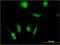 TATA-Box Binding Protein Associated Factor 7 Like antibody, MA5-24476, Invitrogen Antibodies, Immunofluorescence image 