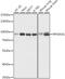 90 kDa ribosomal protein S6 kinase 1 antibody, A15718, ABclonal Technology, Western Blot image 