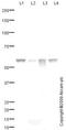 Glucose-6-Phosphate Dehydrogenase antibody, ab76598, Abcam, Western Blot image 