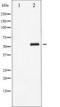 Myocyte Enhancer Factor 2A antibody, TA325685, Origene, Western Blot image 