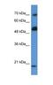 Rho GTPase Activating Protein 36 antibody, NBP1-74250, Novus Biologicals, Western Blot image 