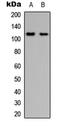 Protein Tyrosine Kinase 2 Beta antibody, LS-C358840, Lifespan Biosciences, Western Blot image 