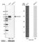 Collagen Type XIII Alpha 1 Chain antibody, NBP2-13854, Novus Biologicals, Western Blot image 