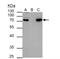 Hematopoietic Cell-Specific Lyn Substrate 1 antibody, NBP2-16787, Novus Biologicals, Immunoprecipitation image 
