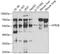 5-Hydroxytryptamine Receptor 2B antibody, 19-784, ProSci, Western Blot image 