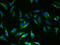 Thyroid Stimulating Hormone Receptor antibody, LS-C317382, Lifespan Biosciences, Immunofluorescence image 