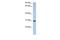 PDZ Domain Containing 9 antibody, GTX45219, GeneTex, Western Blot image 